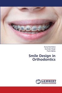bokomslag Smile Design in Orthodontics