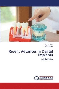 bokomslag Recent Advances In Dental Implants