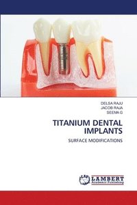 bokomslag Titanium Dental Implants