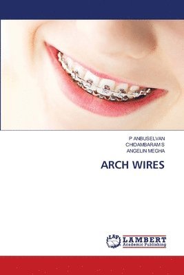 Arch Wires 1