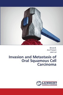 bokomslag Invasion and Metastasis of Oral Squamous Cell Carcinoma