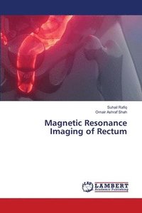 bokomslag Magnetic Resonance Imaging of Rectum