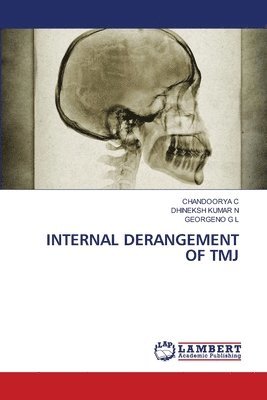 bokomslag Internal Derangement of Tmj