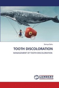 bokomslag Tooth Discoloration