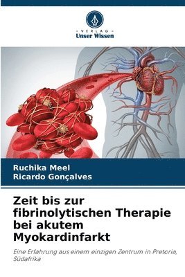 Zeit bis zur fibrinolytischen Therapie bei akutem Myokardinfarkt 1