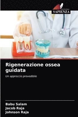 Babu Salam, Jacob Raja, Johnson Raja - Rigenerazione ossea guidata, Häftad