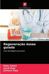 bokomslag Regeneracao ossea guiada