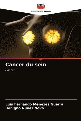 Cancer du sein 1