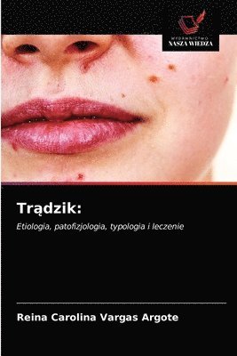 Tr&#261;dzik 1