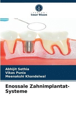 Enossale Zahnimplantat-Systeme 1