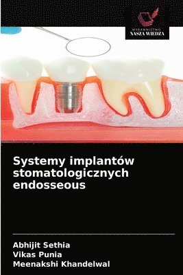 Abhijit Sethia, Vikas Punia, Meenakshi Khandelwal - Systemy implantów stomatologicznych endosseous, Häftad