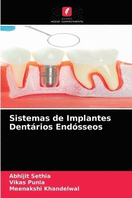 Sistemas de Implantes Dentrios Endsseos 1