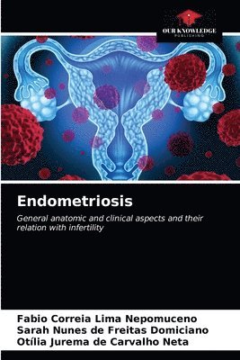 Endometriosis 1