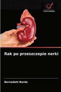 bokomslag Rak po przeszczepie nerki