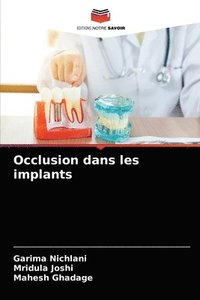 bokomslag Occlusion dans les implants