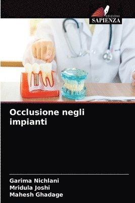 bokomslag Occlusione negli impianti