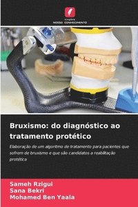 bokomslag Bruxismo: do diagnóstico ao tratamento protético