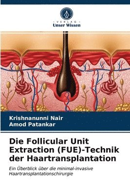 Die Follicular Unit Extraction (FUE)-Technik der Haartransplantation 1