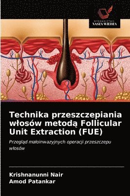 Krishnanunni Nair, Amod Patankar - Technika przeszczepiania wlosów metodą Follicular Unit Extraction (FUE), Häftad