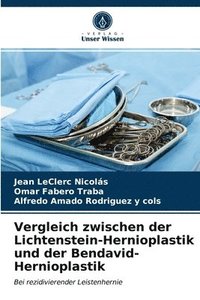 bokomslag Vergleich zwischen der Lichtenstein-Hernioplastik und der Bendavid-Hernioplastik