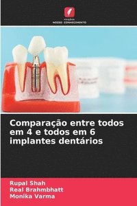 bokomslag Comparação entre todos em 4 e todos em 6 implantes dentários