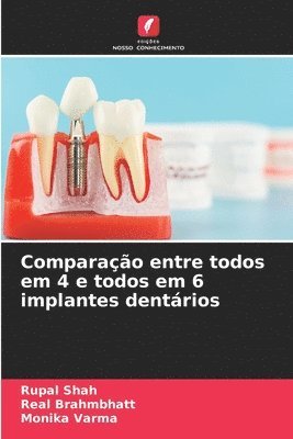 bokomslag Comparação entre todos em 4 e todos em 6 implantes dentários