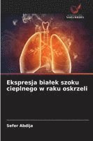 bokomslag Ekspresja bialek szoku cieplnego w raku oskrzeli