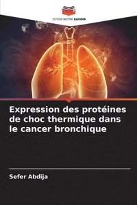 bokomslag Expression des protéines de choc thermique dans le cancer bronchique