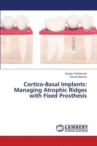 bokomslag Cortico-Basal Implants