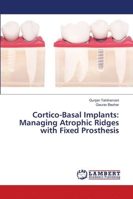 bokomslag Cortico-Basal Implants