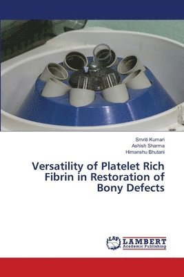 Versatility of Platelet Rich Fibrin in Restoration of Bony Defects 1