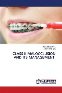 bokomslag Class II Malocclusion and Its Management