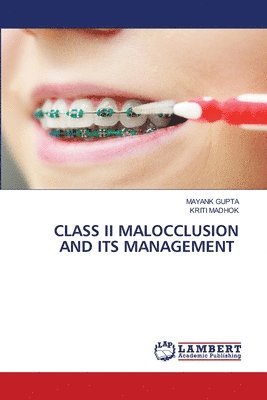 Class II Malocclusion and Its Management 1
