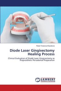 bokomslag Diode Laser Gingivectomy Healing Process