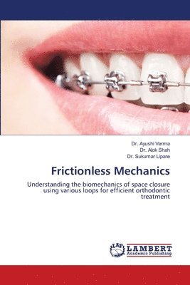 Frictionless Mechanics 1