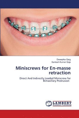 Miniscrews for En-masse retraction 1