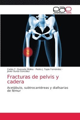 Carlos F Quesada Molina, Pedro J Tapia Fernández, Javier Bureo González, Carlos F. Quesada Molina, Pedro J. Tapia Fernández - Fracturas de pelvis y cadera, Häftad
