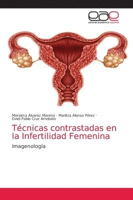 bokomslag Tcnicas contrastadas en la Infertilidad Femenina