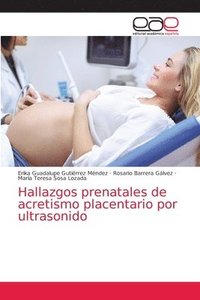 bokomslag Hallazgos prenatales de acretismo placentario por ultrasonido