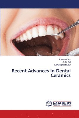 Recent Advances In Dental Ceramics 1