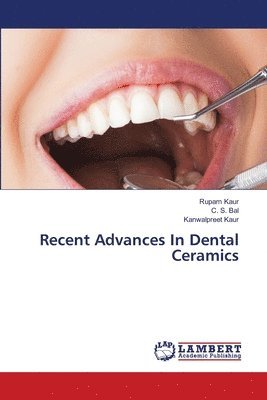 Rupam Kaur, C S Bal, Kanwalpreet Kaur, C. S. Bal, Rupam kaur - Recent Advances In Dental Ceramics, Häftad