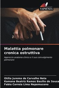 bokomslag Malattia polmonare cronica ostruttiva