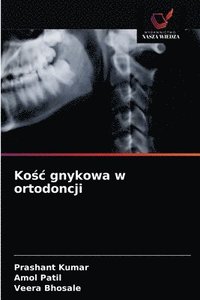 bokomslag Ko&#347;c gnykowa w ortodoncji