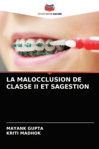 bokomslag La Malocclusion de Classe II Et Sagestion