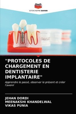 bokomslag &quot;Protocoles de Chargement En Dentisterie Implantaire&quot;