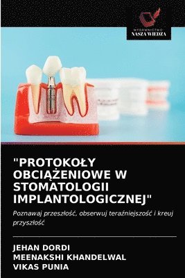 Jehan Dordi, Meenakshi Khandelwal, Vikas Punia, JEHAN Dordi - "Protokoly ObciĄŻeniowe W Stomatologii Implantologicznej", Häftad