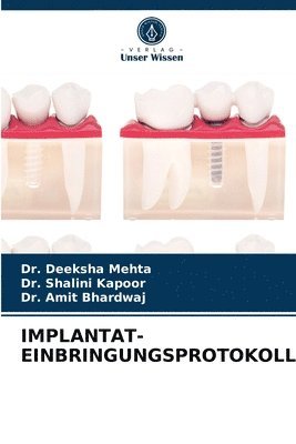 Implantat-Einbringungsprotokoll 1