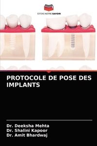 bokomslag Protocole de Pose Des Implants