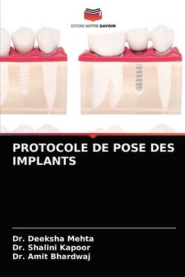 Protocole de Pose Des Implants 1