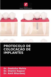 bokomslag Protocolo de Colocao de Implantes